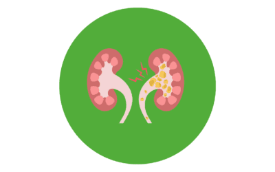 P8 – Poursuivre le travail sur la thématique de la maladie rénale chronique