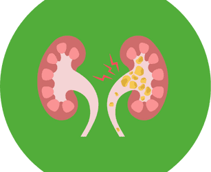 Séances d’information sur la maladie rénale chronique