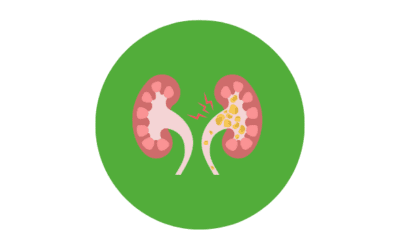 Maladie Rénale Chronique